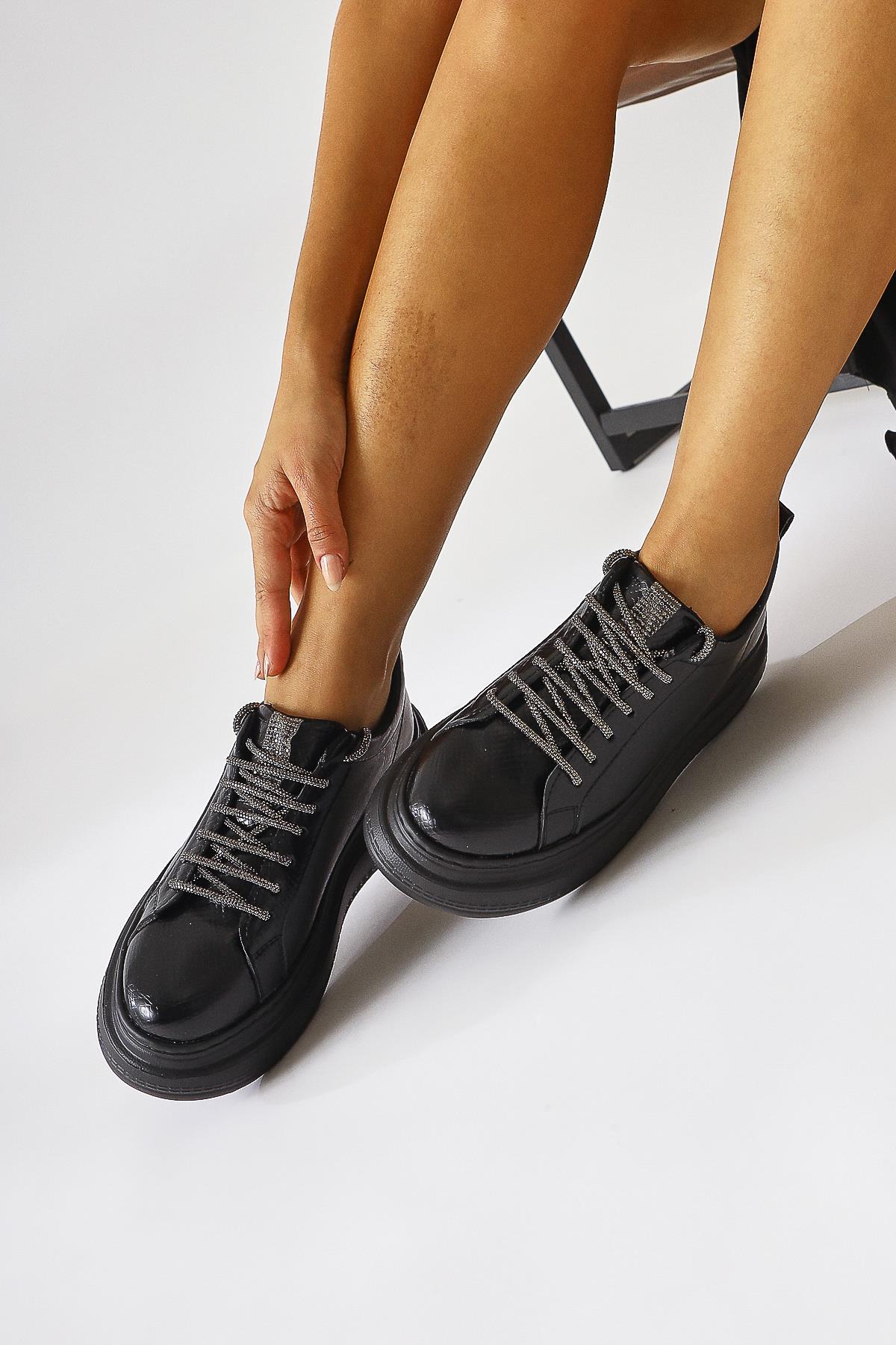 Shake Siyah Taş Detaylı Sneakers (Parlak Bağcık Hediyeli)